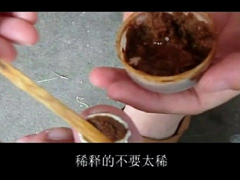 Professional Foot Care (56) Applying medicine and Bandaging infected toes