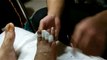 Professional Foot Care (58) Bandaging and Treatment of infected toes