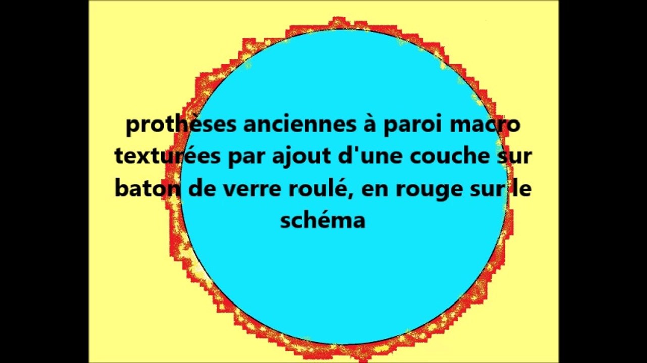 augmentation mammaire après 25 ans:dr vladimir mitz