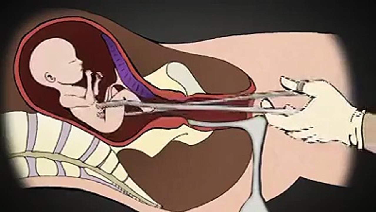 kürtaj-cinayettir-paylaş-herkes-gorsun-