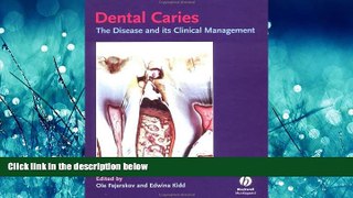 READ book Dental Caries: The Disease and Its Clinical Management [DOWNLOAD] ONLINE