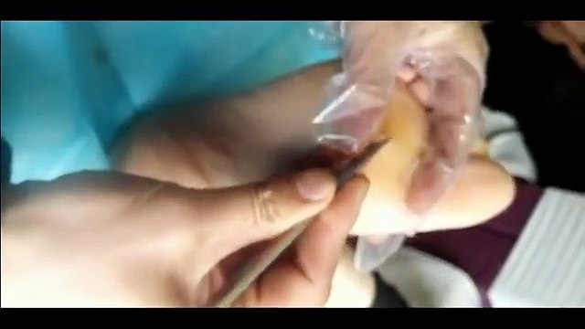 Professional Foot Care (80) Relaxing Treatment of Foot Diseases and Plantar Warts