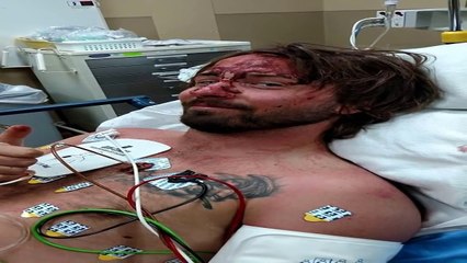 5 Dogs That Died Saving Their Owners Life