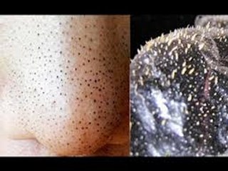 رات کو لیموں کاٹ کر سرہانے رکھنے کا فائدہ  Unbelievable Benefits Of Lemon