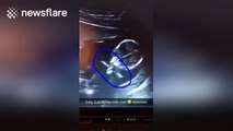 Unborn baby performs the 'Milly Rock' dance