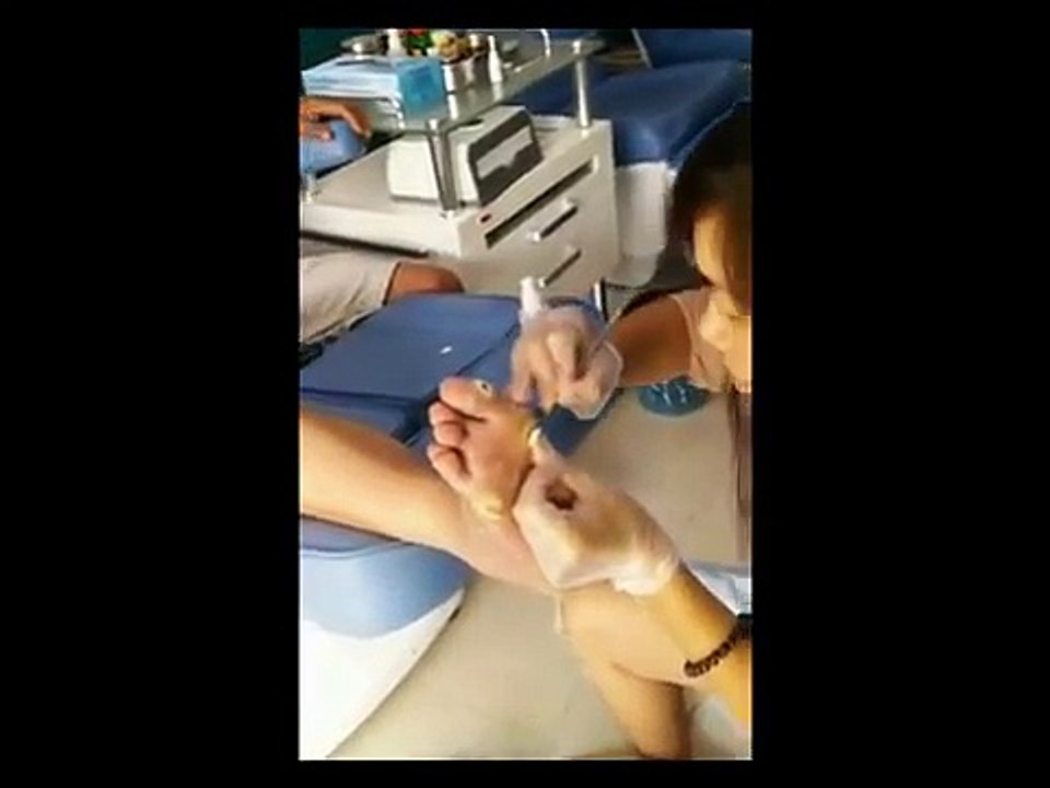 Professional Foot Care (123) Removal of Hard Skin and Treatment of Foot Diseases