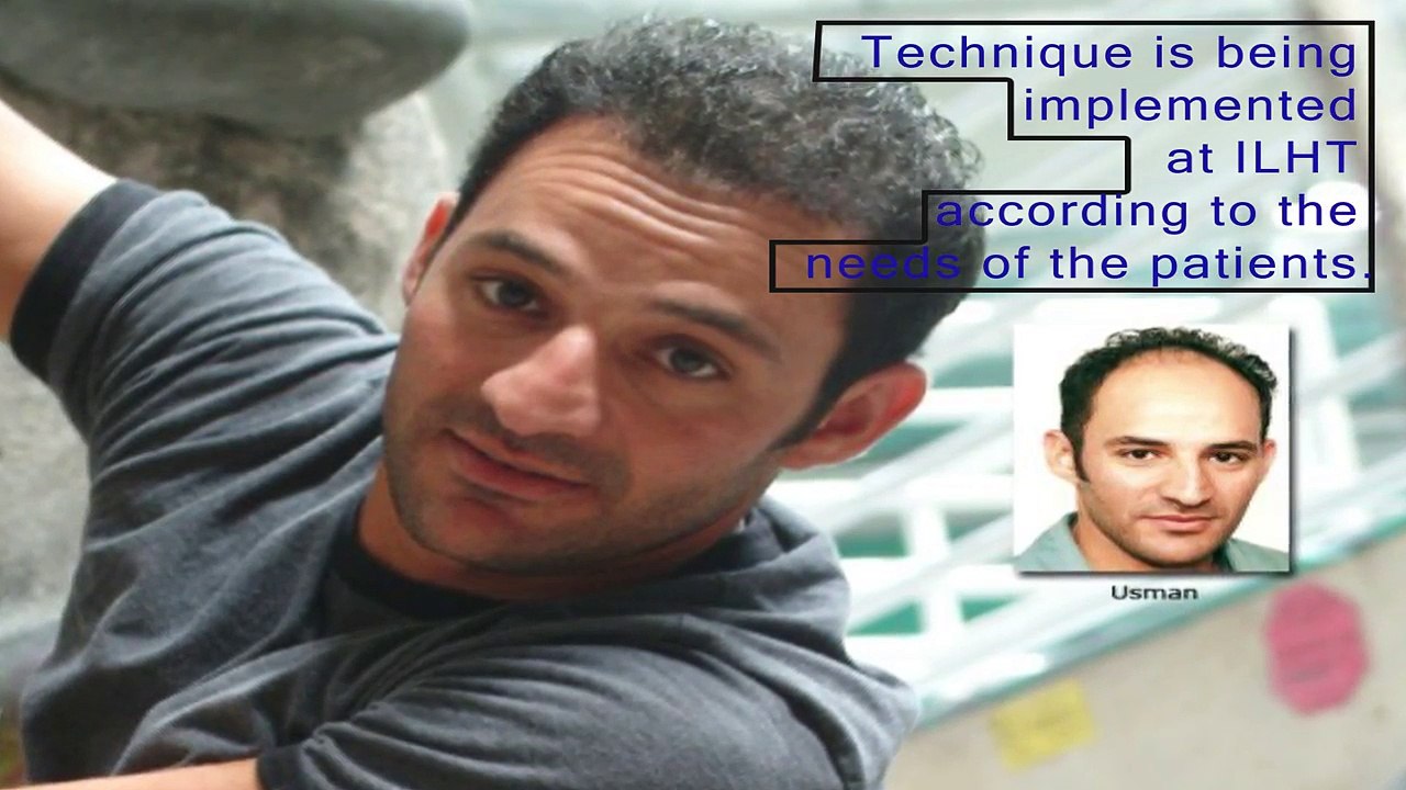 The most renowned and reliable hair transplant center in Pakistan