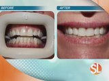 Scottsdale Smiles Dentistry wants to give you a Hollywood smile