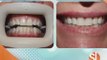 Scottsdale Smiles Dentistry wants to give you a Hollywood smile