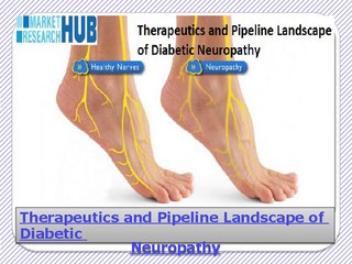 Therapeutics and Pipeline Landscape of Diabetic Neuropathy
