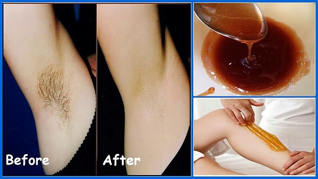 How to Remove Armpit Hair Permanently Body Hair Removal