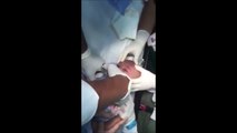 Regardez ce que ce bébé avait avalé... Sauvé de justesse par les docteurs