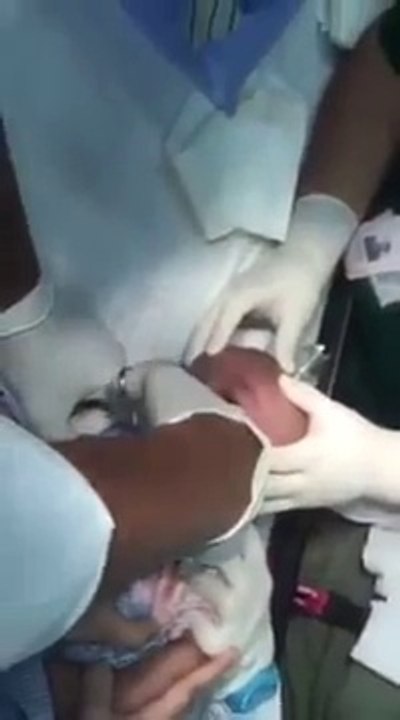 Un bébé arrive très silencieux aux urgences. Ce que les médecins enlèvent de sa gorge est choquant !