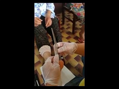 Professional Foot Care (126) Removal of Hard Skin and Treatment of Food Diseases