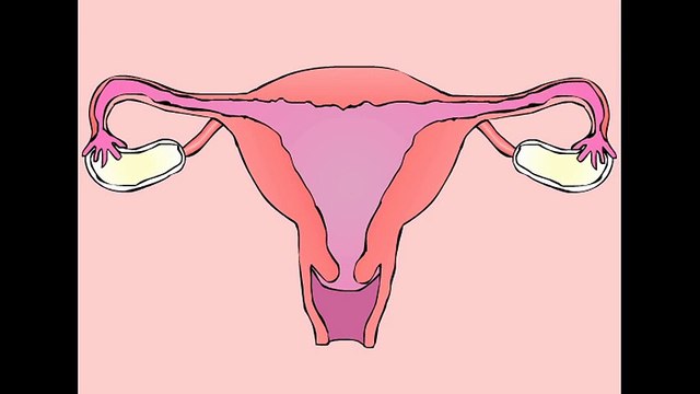 Funny menstruation animation