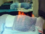 Chinese Fire Therapy (2) Back Detox Relaxation and Stress Relief