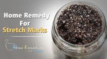 Home Remedy For Stretch Marks | How To Get Rid Of Stretch Marks | Mind Body Soul