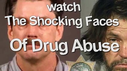 watch the shocking faces of drug abuse
