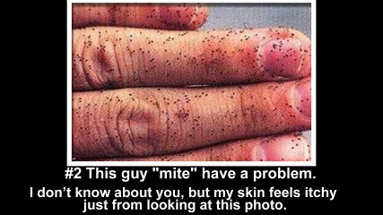watch 7 most disgusting pictures that are actually real