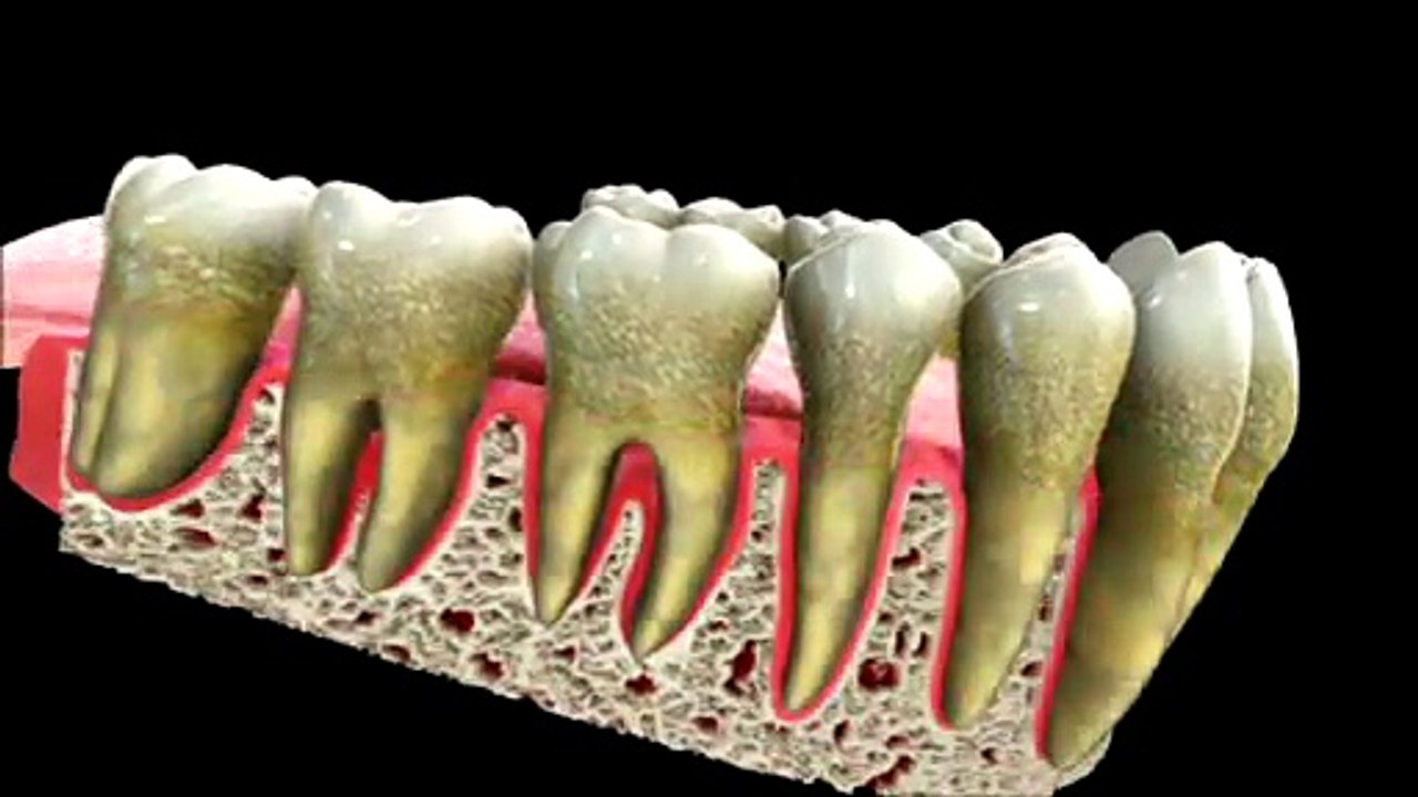 Scaling & Root Planing | Phan-tastic Smiles