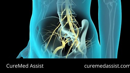 Spinal And Epidural Anesthesia Injecting Anesthesia – CureMed Assist – Medical Tourism Company
