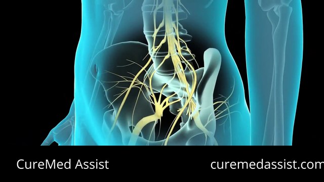 Spinal And Epidural Anesthesia Injecting Anesthesia – CureMed Assist – Medical Tourism Company