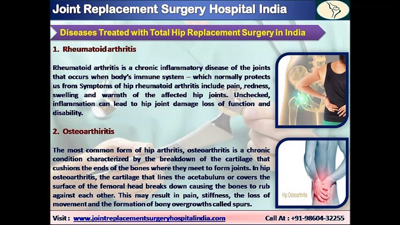 Total Hip Replacement Surgery in India - A New Route for a New Hip