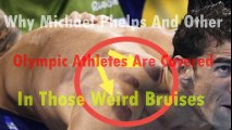 why michael phelps and other olympic athletes are covered in those weird bruises