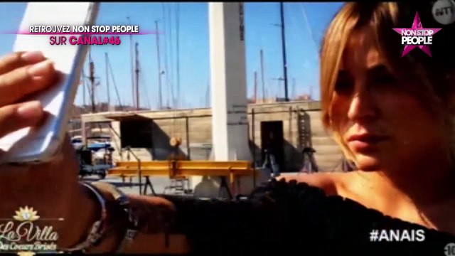 Anaïs Camizuli : son mal-être physique, la chirurgie esthétique... Elle se confie (EXCLU VIDEO)