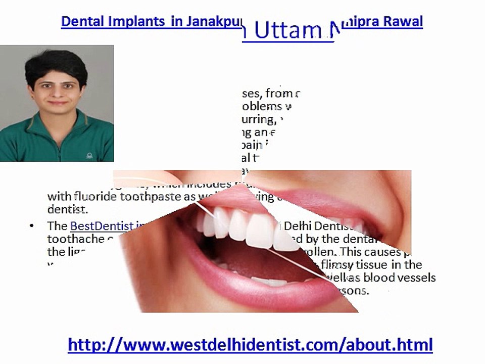Dental Implants in West ,Delhi Best dentist in West ,DelhiDental clinic in Janakpuri by Dr.Shipra Rawal