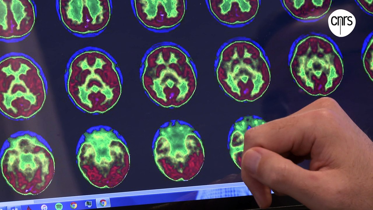 Comprendre le cerveau traumatisé