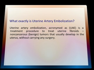 Everything You Need to Know About Revolutionary Treatment Procedure For Fibroids