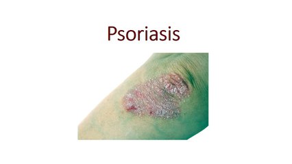 Psoriasis Explained: Causes, Symptoms, and Treatments 🩺