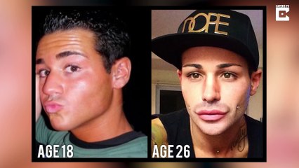 Après 100 opérations et 150h il pense avoir atteint la perfection physique... WTF