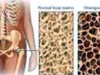 Dangers of drinking cow's milk