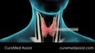 Thyroidectomy Thyroid Gland Thyroid Cancer Thyroid Surgery – CureMed Assist – Medical Tourism Company