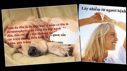 Tổng hợp những nguyên nhân gây nấm da đầu phổ biến