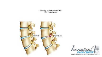 Treating Herniated Disc And Other Conditions