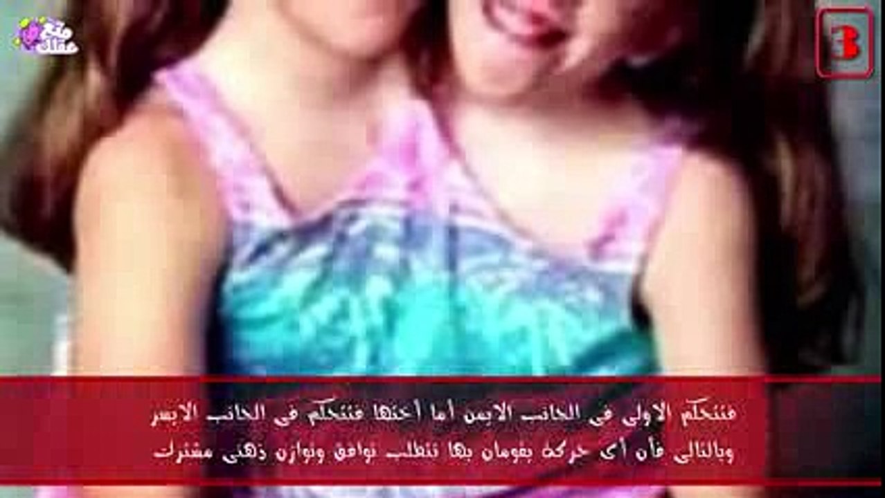 10 أشخاص بأعضاء جسدية إضافية