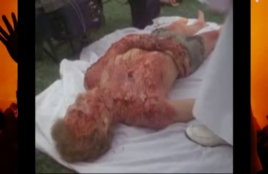 Piranha Fish Attack Human And Piranha Attacks Video Compilation   When Animals Attack