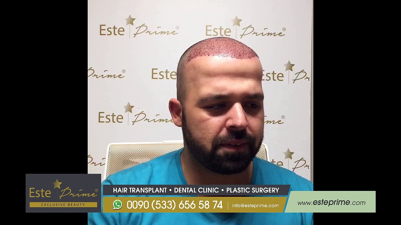 Hair Transplant