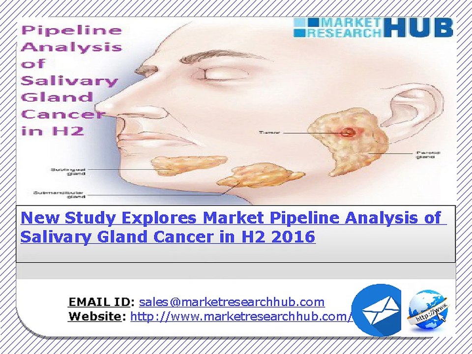 New Study Explores Market Pipeline Analysis of Salivary Gland Cancer in H2 2016