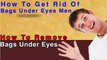 how to remove dark circles - How to Gid Rid of Bags Under Eyes
