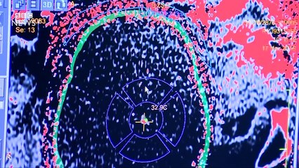 Sound waves used for deep brain surgery - BBC News