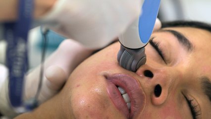 Hannah Bronfman Getting a Vampire Facial Looks So Intense!