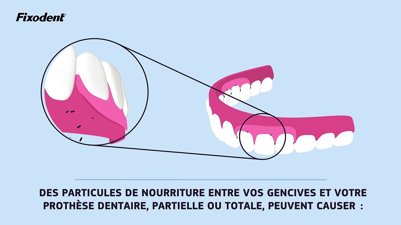 Rien ne passe avec Fixodent anti-particules - Fixodent