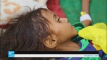 موت طفل يمني كل عشر دقائق بسبب سوء التغذية وانتشار الأمراض