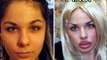 Plastic Surgery Gone Horribly Wrong - Worst Plastic Surgery Ever - Version 3