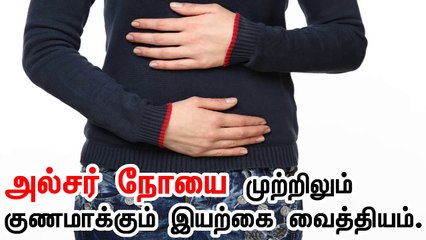 அல்சர் நோயை முற்றிலும் குணமாக்கும் இயற்கை வைத்தியம். Home Remedies for Ulcer Treatment in tamil.