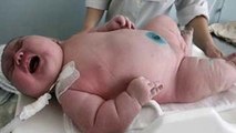 Une femme de 300 kilos aurait donné naissance à un bébé de 20 kilos.